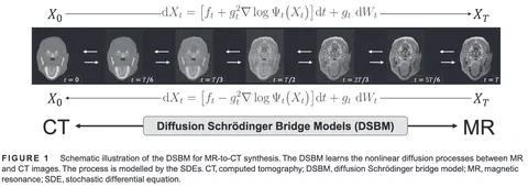 Diffusion Schrödinger bridge models for high-quality MR-to-CT synthesis for proton treatment planning