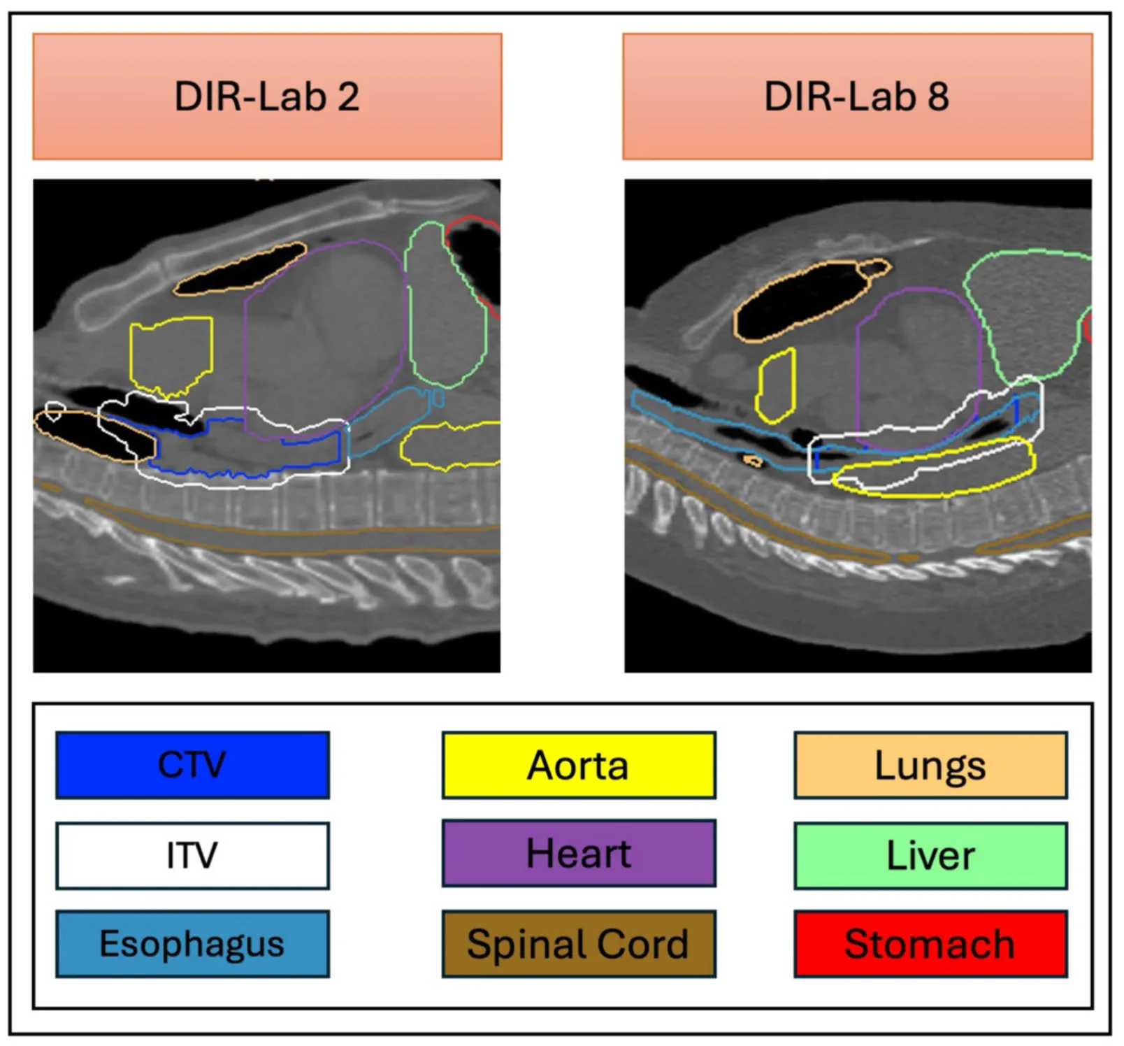 Comparative evaluation of static and dynamic 4D dose recalculations in pencil beam scanning proton therapy for oesophageal cancer