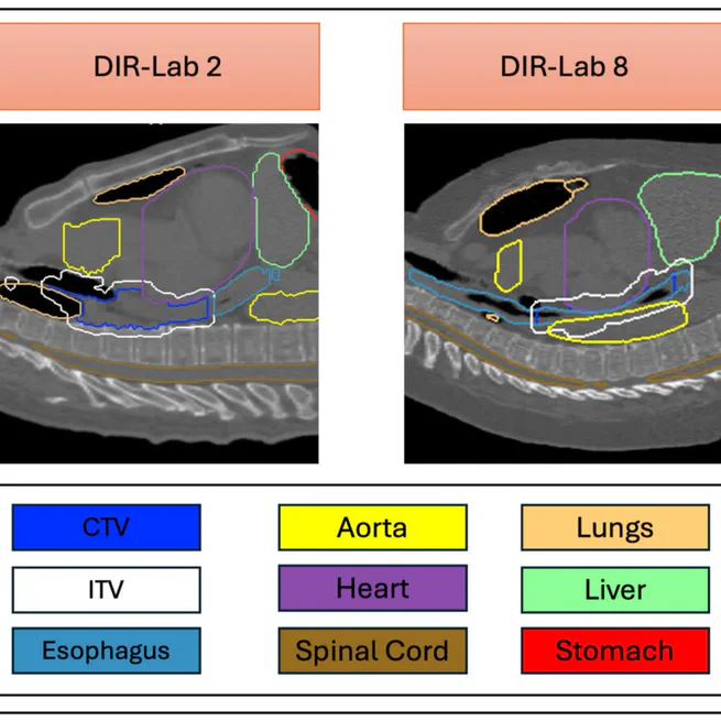 Comparative evaluation of static and dynamic 4D dose recalculations in pencil beam scanning proton therapy for oesophageal cancer