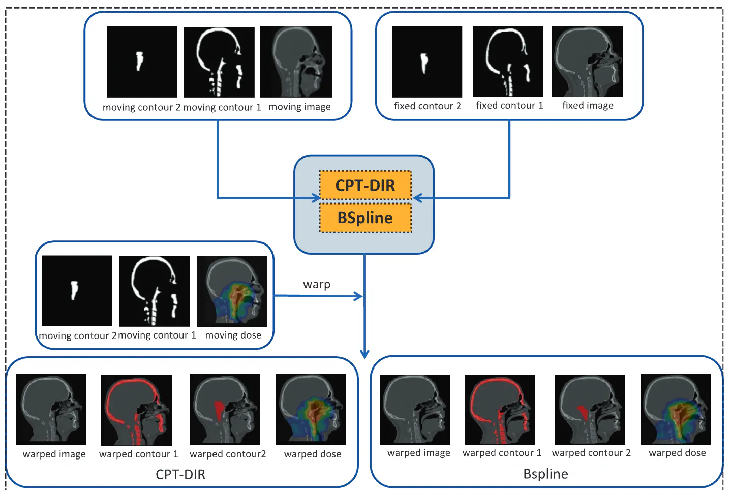 Contour-informed inter-patient deformable registration for more reliable voxel-based analysis of Head-and-Neck cancer patients